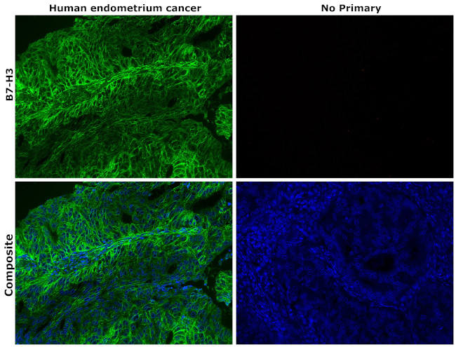 B7-H3 (CD276) Antibody in Immunohistochemistry (Paraffin) (IHC (P))