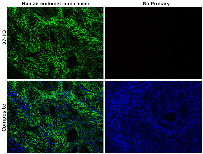 B7-H3 (CD276) Antibody in Immunohistochemistry (Paraffin) (IHC (P))