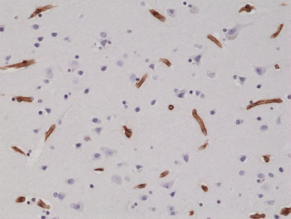 Integrin beta 1 (CD29) Antibody in Immunohistochemistry (Paraffin) (IHC (P))