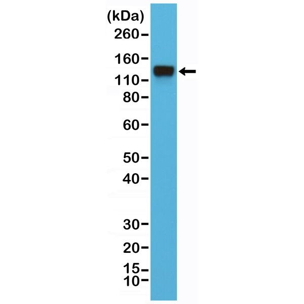 Integrin beta 1 (CD29) Antibody in Western Blot (WB)