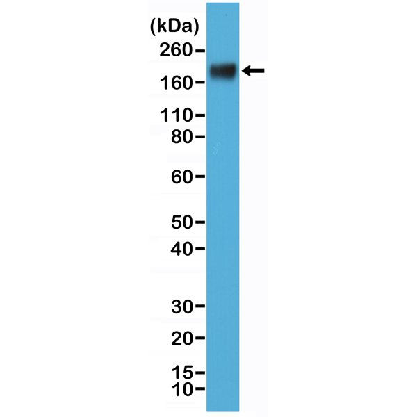 CD66e (CEA) Antibody in Western Blot (WB)