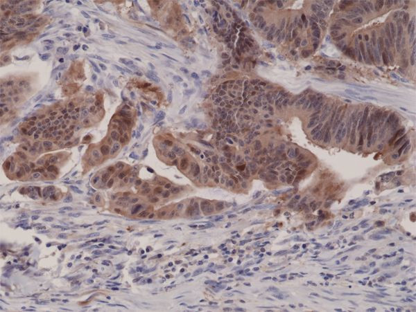 p16INK4a Antibody in Immunohistochemistry (Paraffin) (IHC (P))