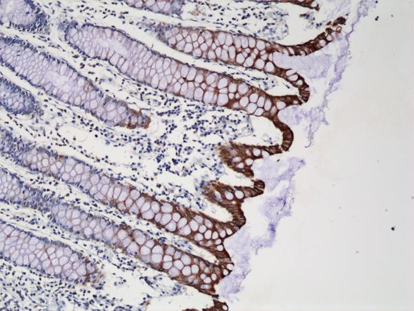 Cytokeratin 20 Antibody in Western Blot (WB)