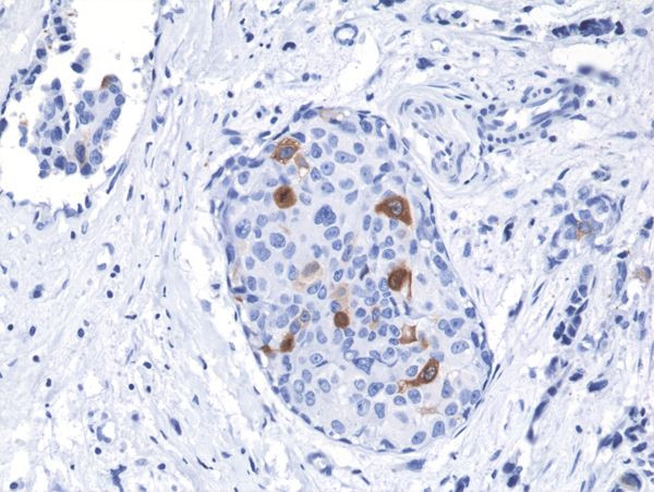 Cyclin B1 Antibody in Immunohistochemistry (Paraffin) (IHC (P))