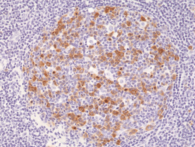 Cyclin B1 Antibody in Immunohistochemistry (Paraffin) (IHC (P))