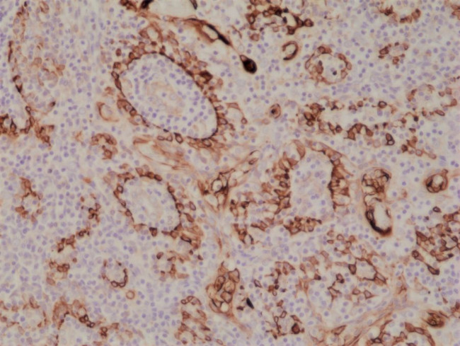 Cytokeratin 17 Antibody in Immunohistochemistry (Paraffin) (IHC (P))