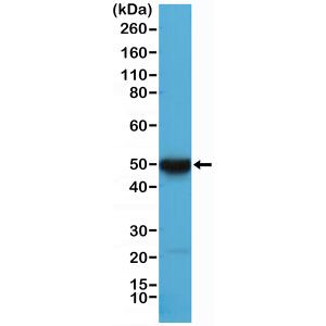 Cytokeratin 17 Antibody in Western Blot (WB)