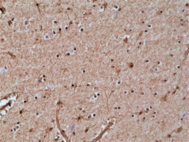 GSTP1 Antibody in Immunohistochemistry (Paraffin) (IHC (P))