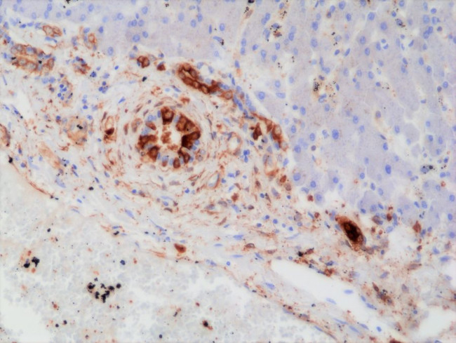 GSTP1 Antibody in Immunohistochemistry (Paraffin) (IHC (P))