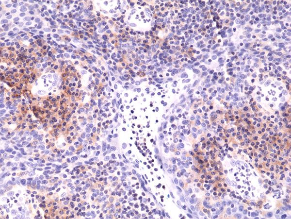 CD49d (Integrin alpha 4) Antibody in Immunohistochemistry (Paraffin) (IHC (P))