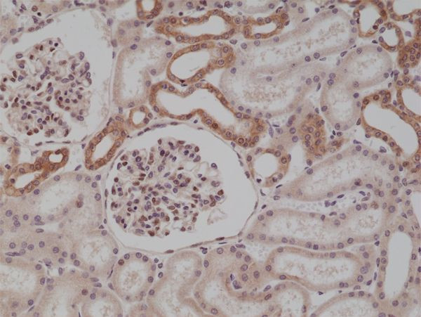 MyD88 Antibody in Immunohistochemistry (Paraffin) (IHC (P))