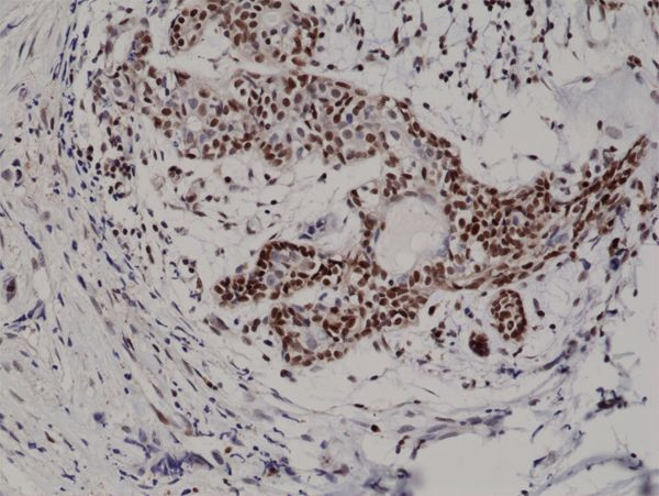 p27Kip1 Antibody in Immunohistochemistry (Paraffin) (IHC (P))