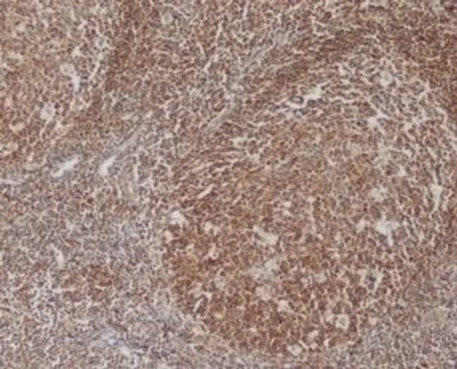 Bcl-10 Antibody in Immunohistochemistry (Paraffin) (IHC (P))