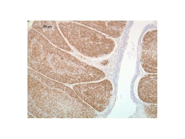 CD268 (BAFF Receptor) Antibody in Immunohistochemistry (Paraffin) (IHC (P))