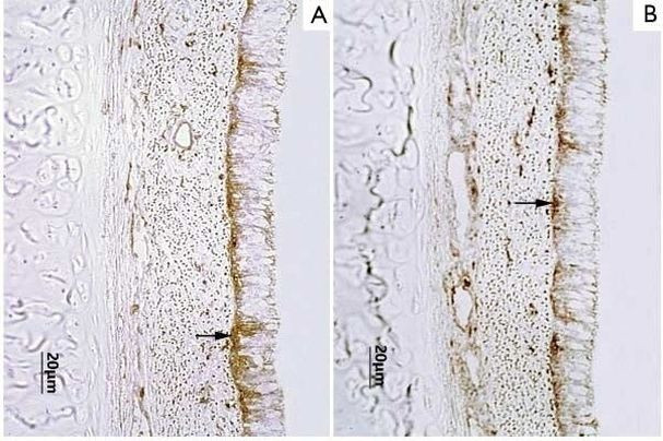 MHC II Monomorphic Antibody in Immunohistochemistry (Frozen) (IHC (F))