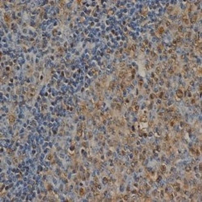 Ubiquitin Antibody in Immunohistochemistry (Paraffin) (IHC (P))