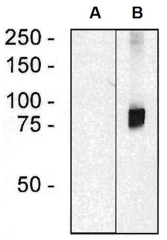 ARHGEF4 Antibody in Western Blot (WB)