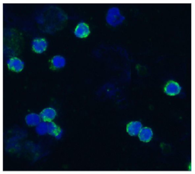 CD18 (LFA-1 beta) Antibody in Immunocytochemistry (ICC/IF)