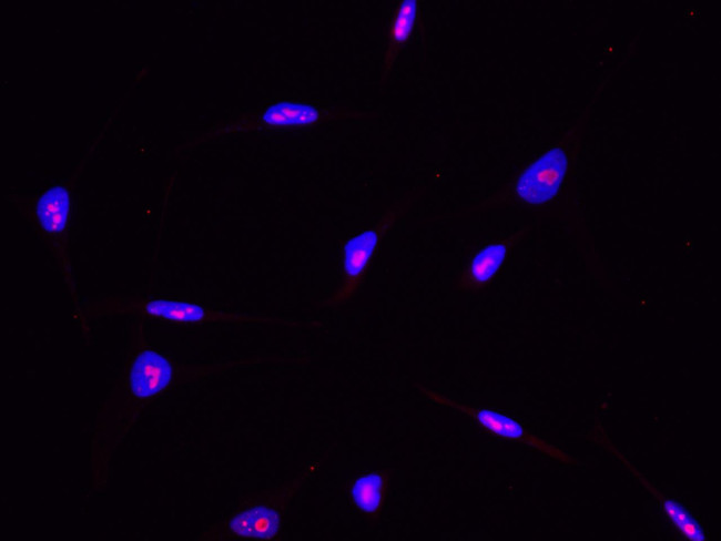 ABHEB Antibody in Immunocytochemistry (ICC/IF)