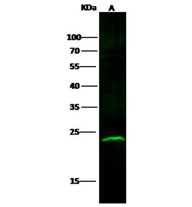 ABHEB Antibody in Western Blot (WB)