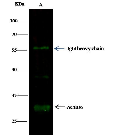 ACBD6 Antibody in Immunoprecipitation (IP)