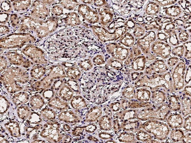 ACOX1 Antibody in Immunohistochemistry (Paraffin) (IHC (P))