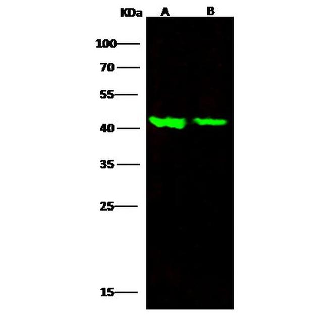 ACVRL1 Antibody in Western Blot (WB)