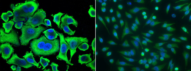 Aminoacylase Antibody in Immunocytochemistry (ICC/IF)