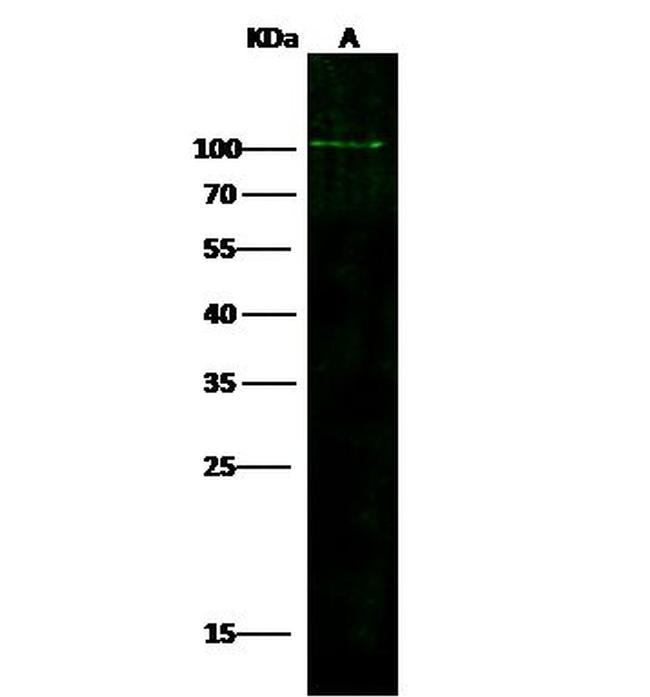 ADAM12 Antibody in Western Blot (WB)