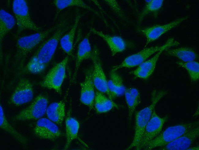 ADAM15 Antibody in Immunocytochemistry (ICC/IF)