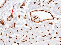 ADAM15 Antibody in Immunohistochemistry (Paraffin) (IHC (P))