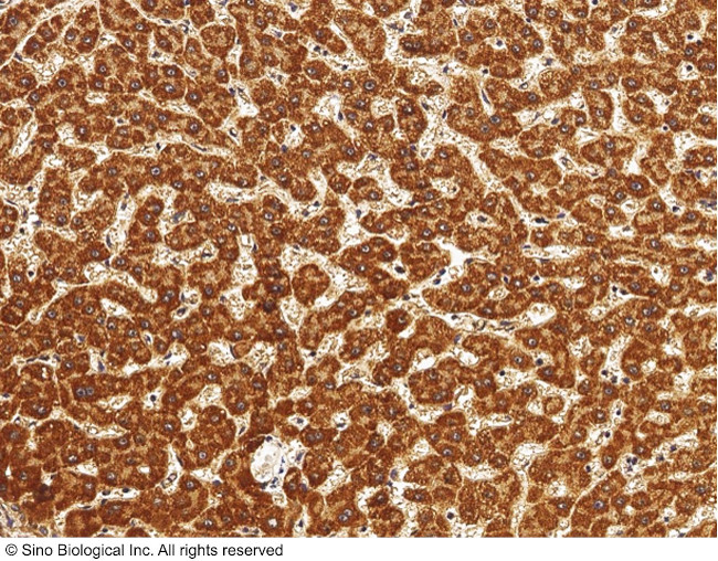 ALDH7A1 Antibody in Immunohistochemistry (Paraffin) (IHC (P))