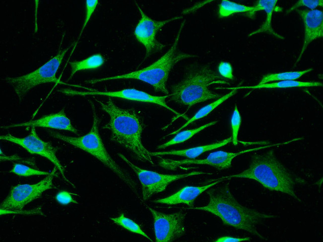 ALDH7A1 Antibody in Immunocytochemistry (ICC/IF)