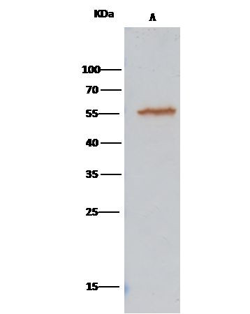 ALDH7A1 Antibody in Immunoprecipitation (IP)