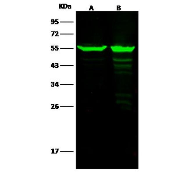 ALDH7A1 Antibody in Western Blot (WB)