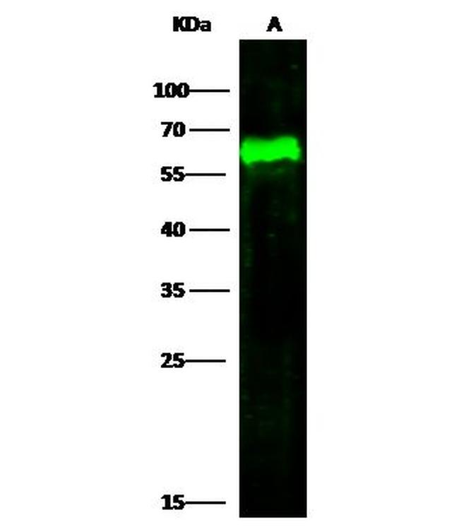 Arylsulfatase A Antibody in Western Blot (WB)