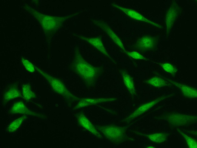 ASF1B Antibody in Immunocytochemistry (ICC/IF)