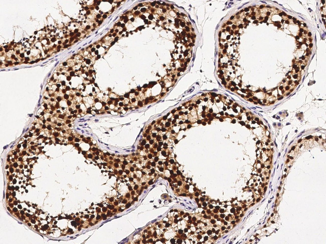 ASF1B Antibody in Immunohistochemistry (Paraffin) (IHC (P))