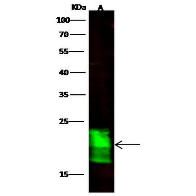 ASF1B Antibody in Western Blot (WB)