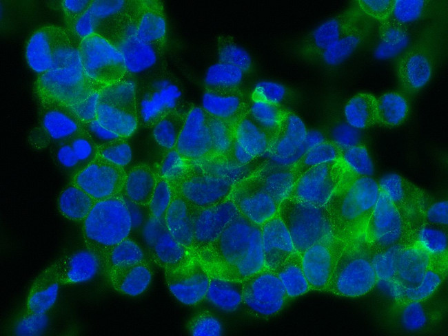 ASGR2 Antibody in Immunocytochemistry (ICC/IF)