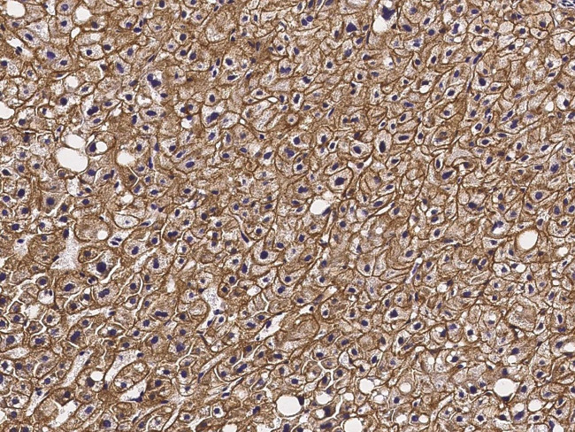 ASGR2 Antibody in Immunohistochemistry (Paraffin) (IHC (P))