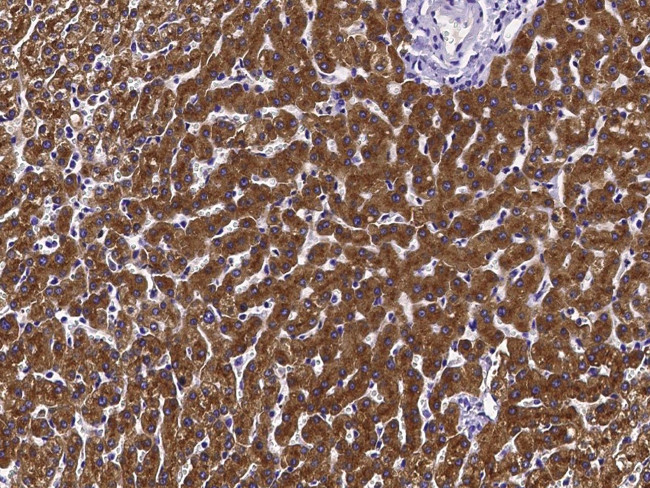 ASGR2 Antibody in Immunohistochemistry (Paraffin) (IHC (P))