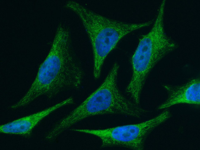 BID Antibody in Immunocytochemistry (ICC/IF)