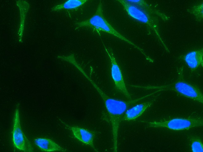 BMP-4 Antibody in Immunocytochemistry (ICC/IF)