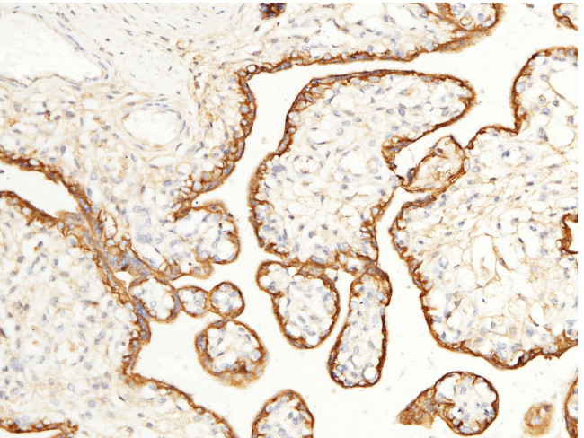 CD147 Antibody in Immunohistochemistry (Paraffin) (IHC (P))