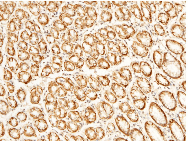 CD147 Antibody in Immunohistochemistry (Paraffin) (IHC (P))