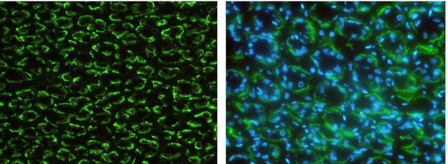 CD147 Antibody in Immunohistochemistry (Paraffin) (IHC (P))