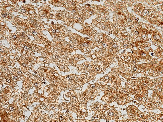 Complement C5 Antibody in Immunohistochemistry (Paraffin) (IHC (P))