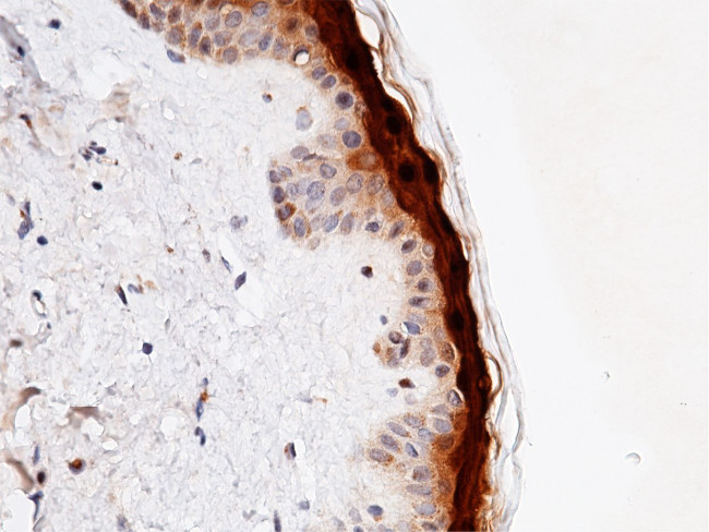 CALML5 Antibody in Immunohistochemistry (Paraffin) (IHC (P))