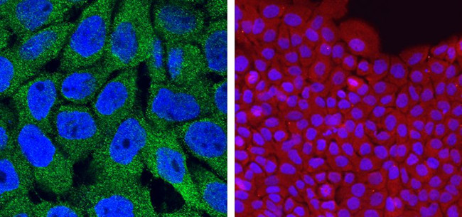 Caspase 14 Antibody in Immunocytochemistry (ICC/IF)